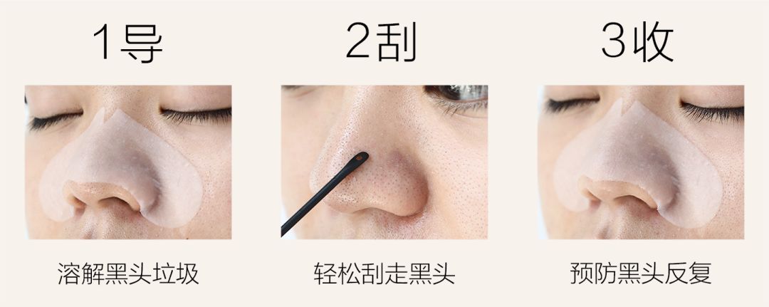 如何摆脱黑头反复的困扰才最有效,用黑头仪吸完黑头黑头还会再长吗