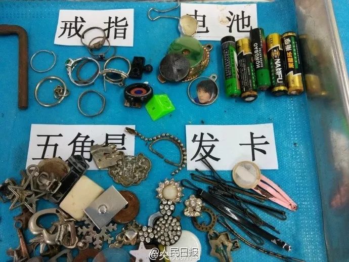 3岁女童患怪病肚子大如球,7岁女童突然腹痛元凶竟是畸胎瘤