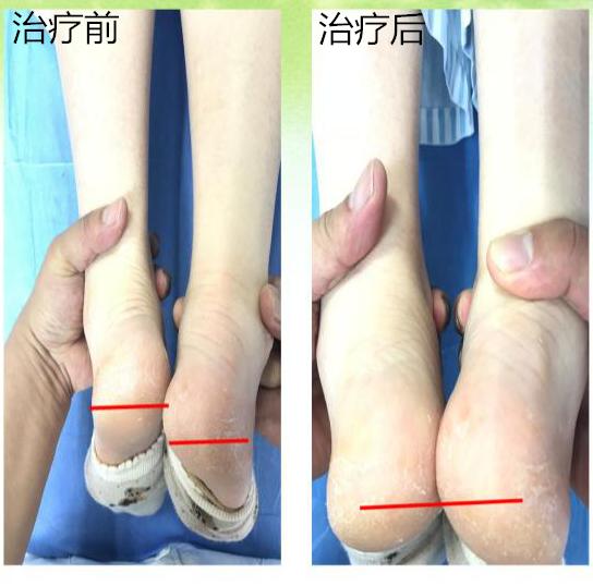 产后妈妈的守护神,保护好自己产后妈妈必看