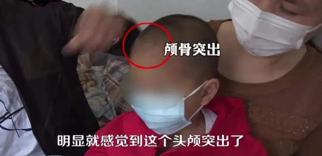 大头娃娃奶粉事件判刑,大头娃娃奶粉事件央视