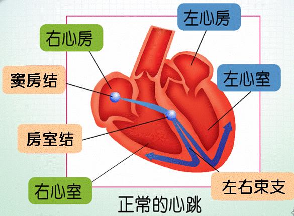 心动过缓不要慌，心脏起搏器来帮忙