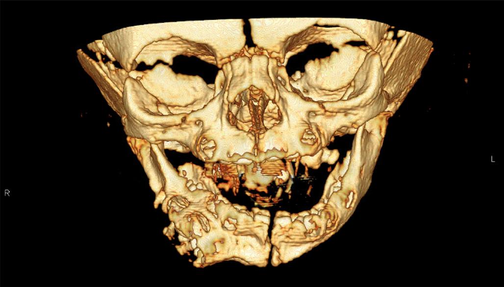 七个月婴儿老张嘴怎么回事,一个婴儿有两张嘴