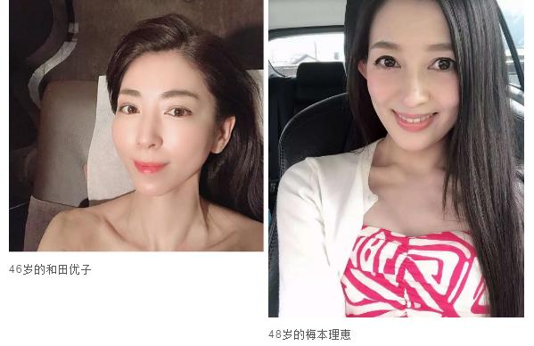 抬头纹眉间纹怎么去除,眉间纹抬头纹去除最好的方法