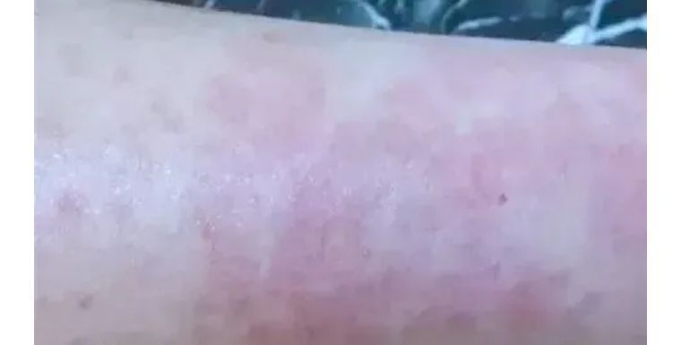 j-style脱毛仪怎么用,j-style脱毛仪怎样