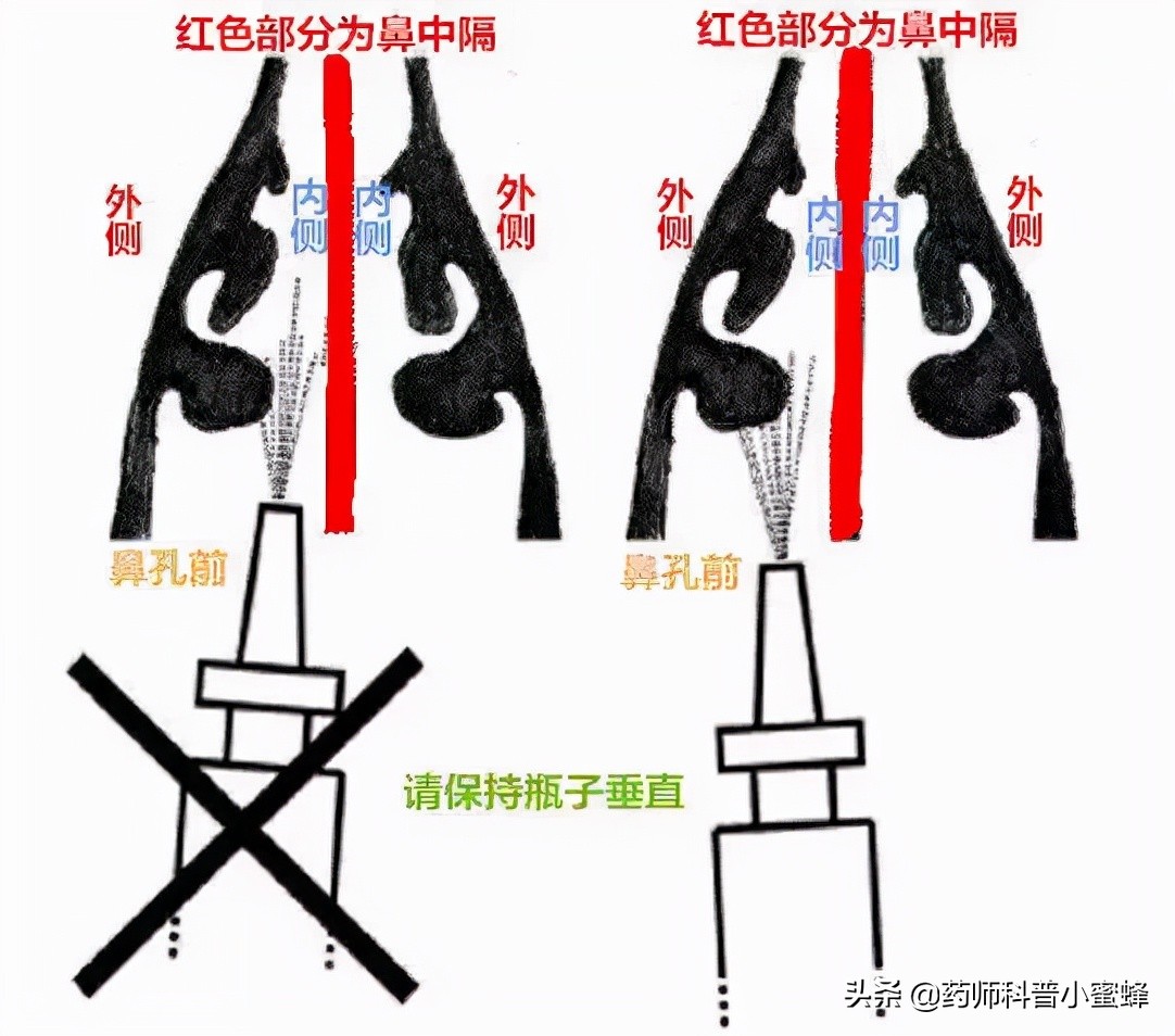鼻喷雾剂怎么使用不会流到嘴里,使用鼻喷剂后避免出血