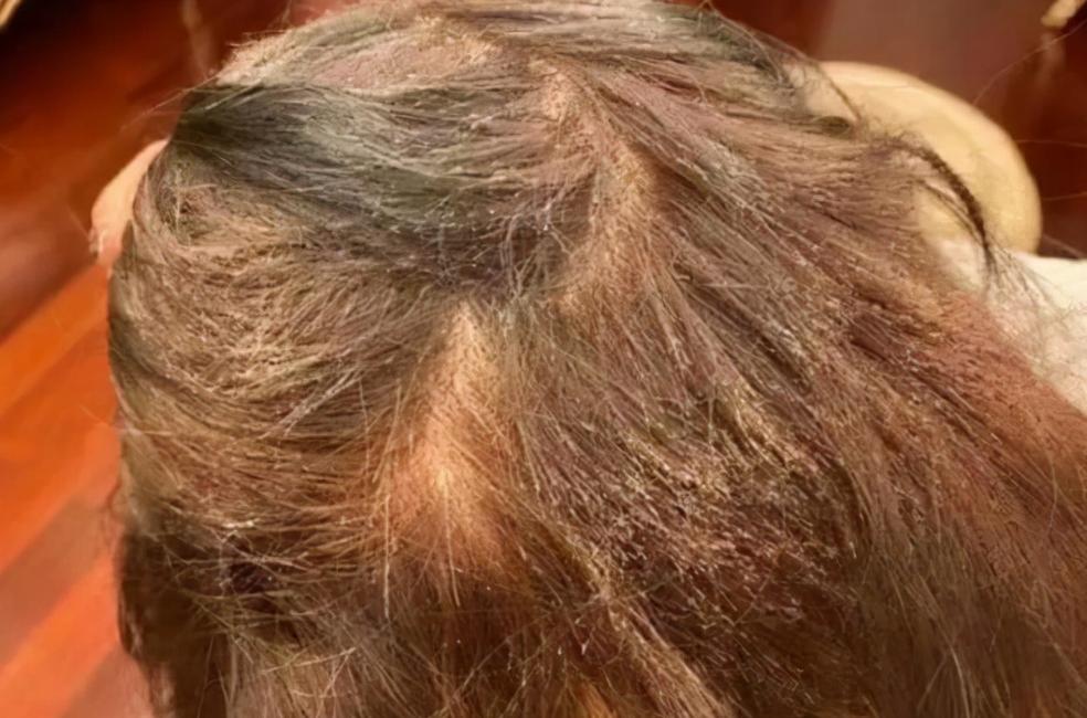 “我丑得出不了门！”女大学生花1000块染发变成这副模样：赔我20万