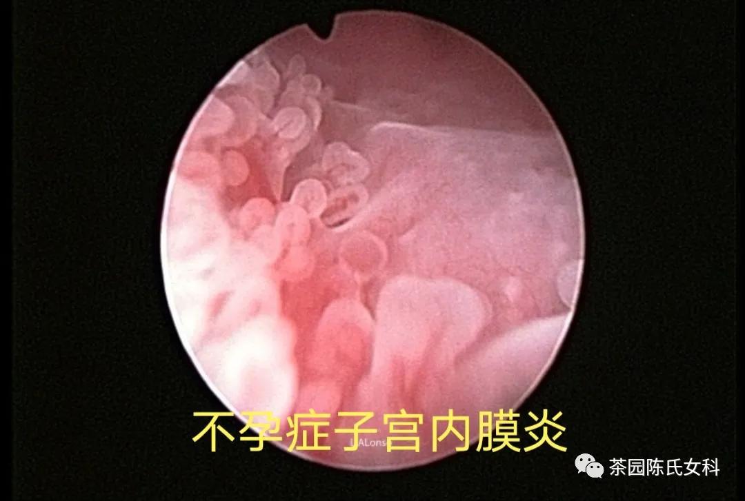 哪些妇科病会引起出血呢,排卵期出血是妇科病吗