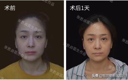 极脂胶丰卧蚕｜这“蚕宝宝”好神奇，从此我也有一双会笑的眼睛了