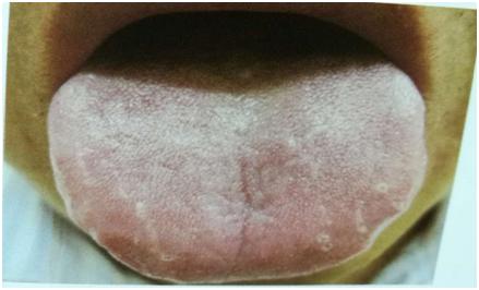 中医经典舌诊和中医全息舌诊区别,中医舌诊知识大全图片