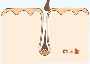 脱落的头发有白色颗粒是毛囊么,连毛囊一起脱落的头发图片