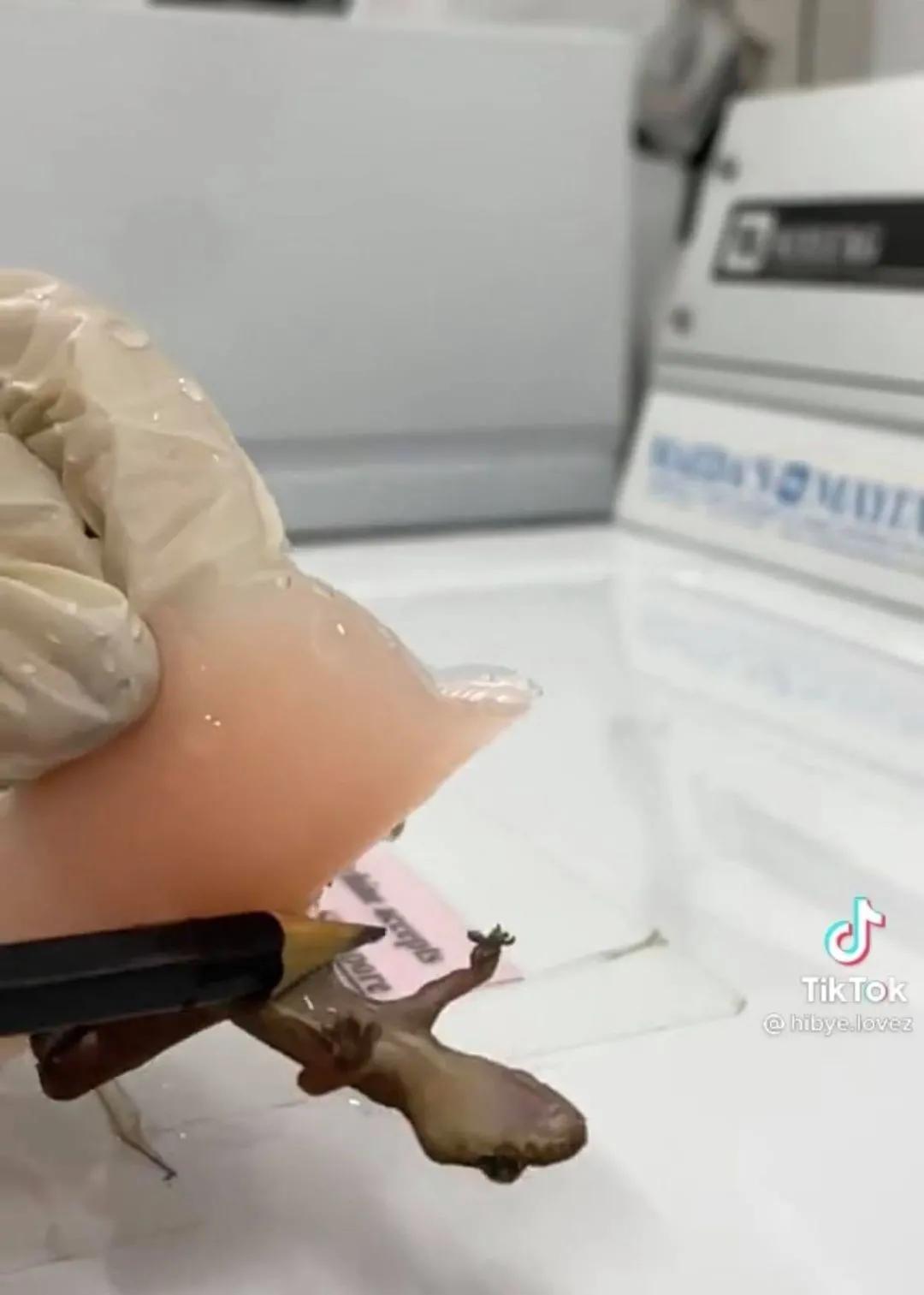 NTU一女生发现胸贴意外丢失，究竟是谁在作祟？