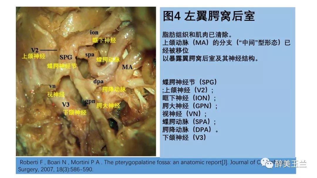 病例分享丨三叉神经节微球囊压迫术的麻醉管理