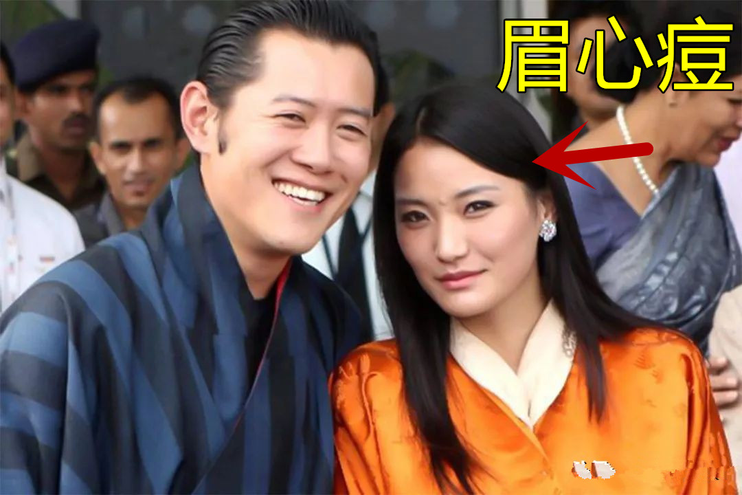 佩玛王后一颗“眉心痘”，不再面无表情冷冰冰，慈眉善目多了温柔