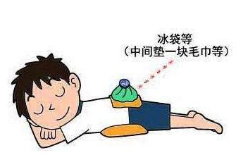 急性腰扭伤如何快速恢复,如何预防腰扭伤