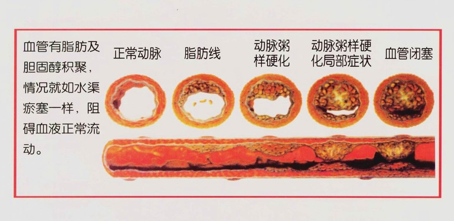 血管堵塞脚先知,脚毛细血管堵塞的十大征兆
