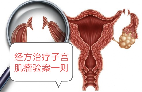 桂枝茯苓丸治疗子宫肌瘤,桂枝茯苓丸治疗子宫肌瘤原理