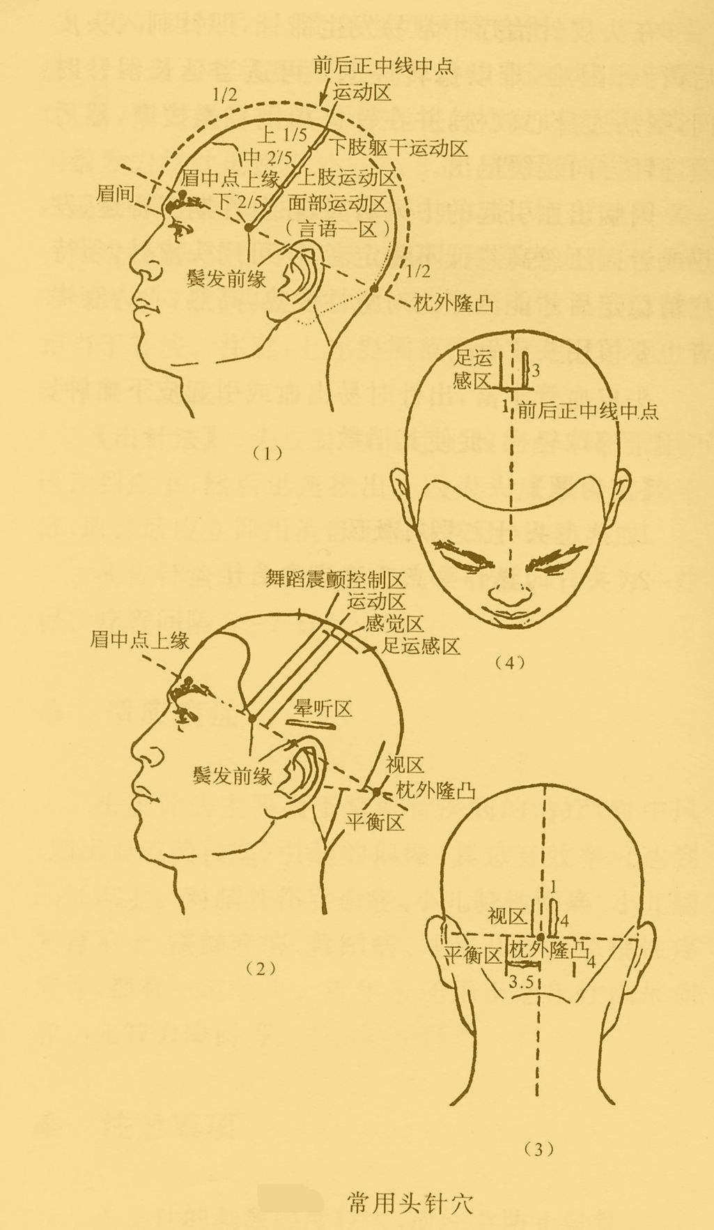 针灸治疗精神疾病的优势病种有哪些？