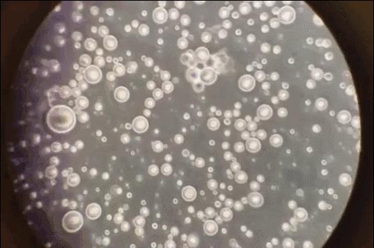 母乳放大100倍原来真的是血做的,母乳在显微镜下被放大1000倍