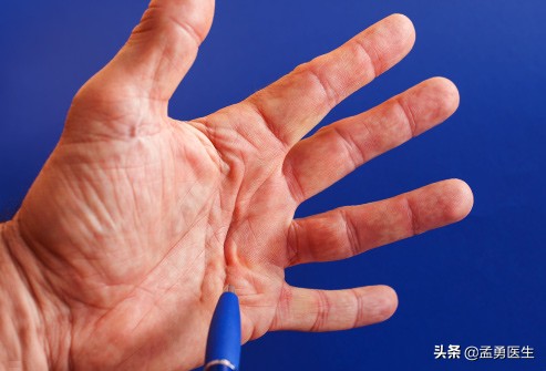 医生告诉你手粗怎么变细,医生教你手变软