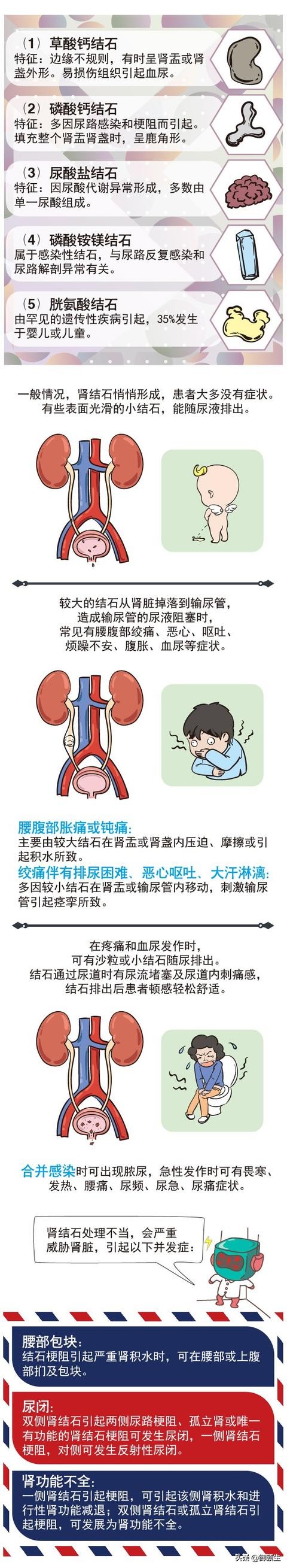 肾结石碎石后会引起肾衰竭吗,肾结石最终导致肾衰的概率大吗