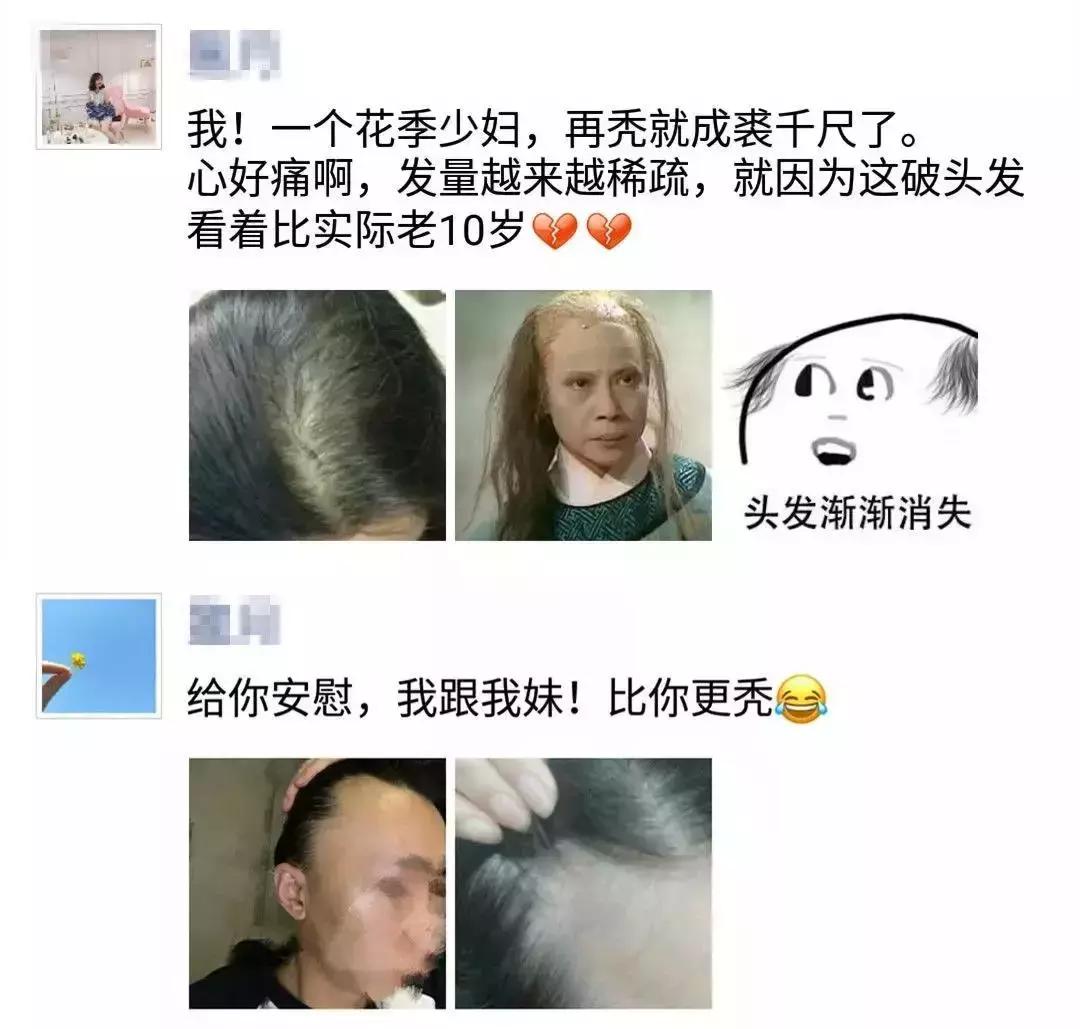 发际线高头发稀疏掉头发怎么拯救,发际线后移的头发还能长出来么