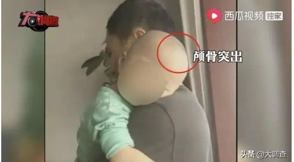 劣质奶粉大头娃娃事件,大头娃娃最假奶粉事件后续调查