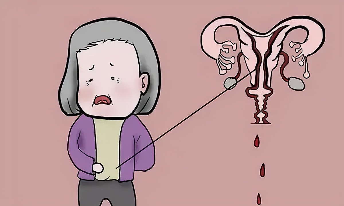 “上环”坑了一代女性？今天为它正名