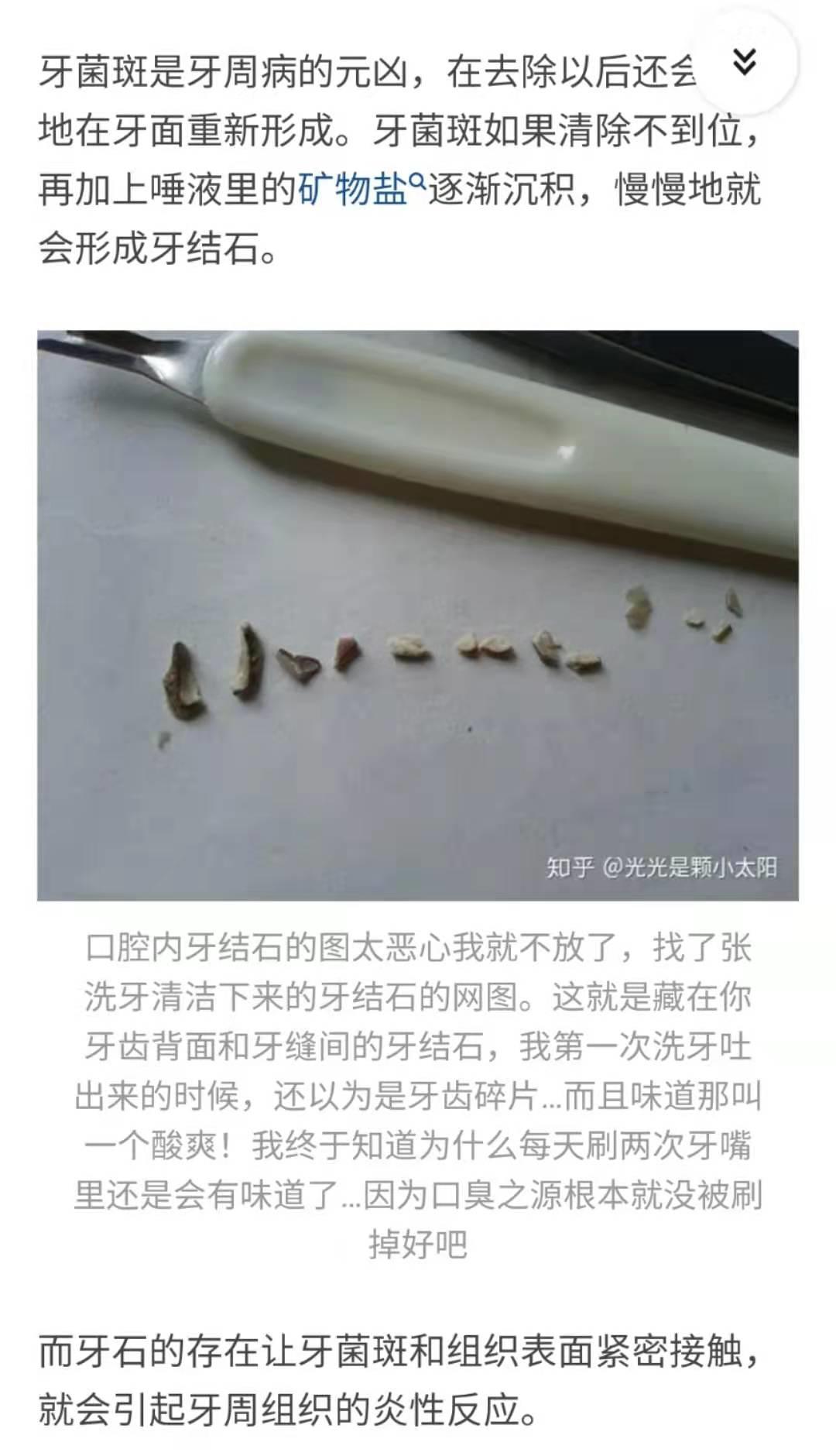 被牙疼折磨的姑娘,被牙痛折磨的人