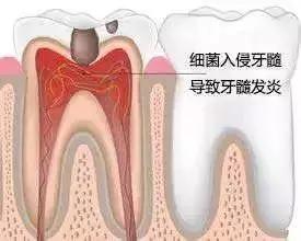 牙齿痛怎么办教你一招搞定牙痛,牙痛怎么样判断牙齿什么问题