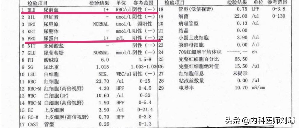 过敏性紫癜不治疗会引起肾炎吗,过敏性紫癜不出现肾损害