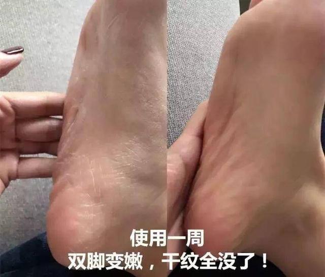 日本版“大宝SOD蜜”，多次荣获口碑大奖，深度滋养拒绝干纹