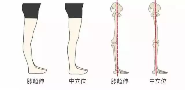 如何正确的瘦小腿,如何一周内快速瘦小腿