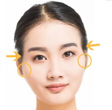 颧骨高面部填充好还是内推好,改善颧骨宽大
