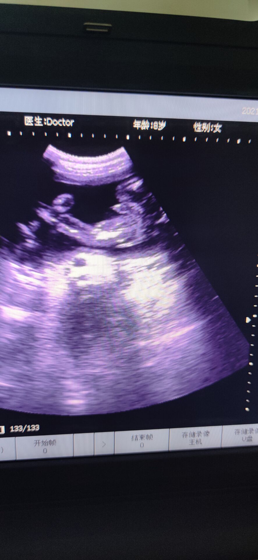 开始有多幸福结束就有多痛,有过伤心和难过也有快乐和幸福