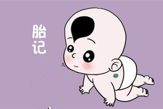 小孩常见的胎记都有哪些,宝宝的胎记有什么寓意