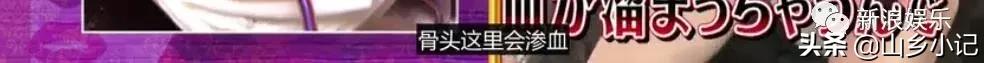 明明是整容脸现在却成了颜值巅峰,明明是整容脸却没被吐槽过