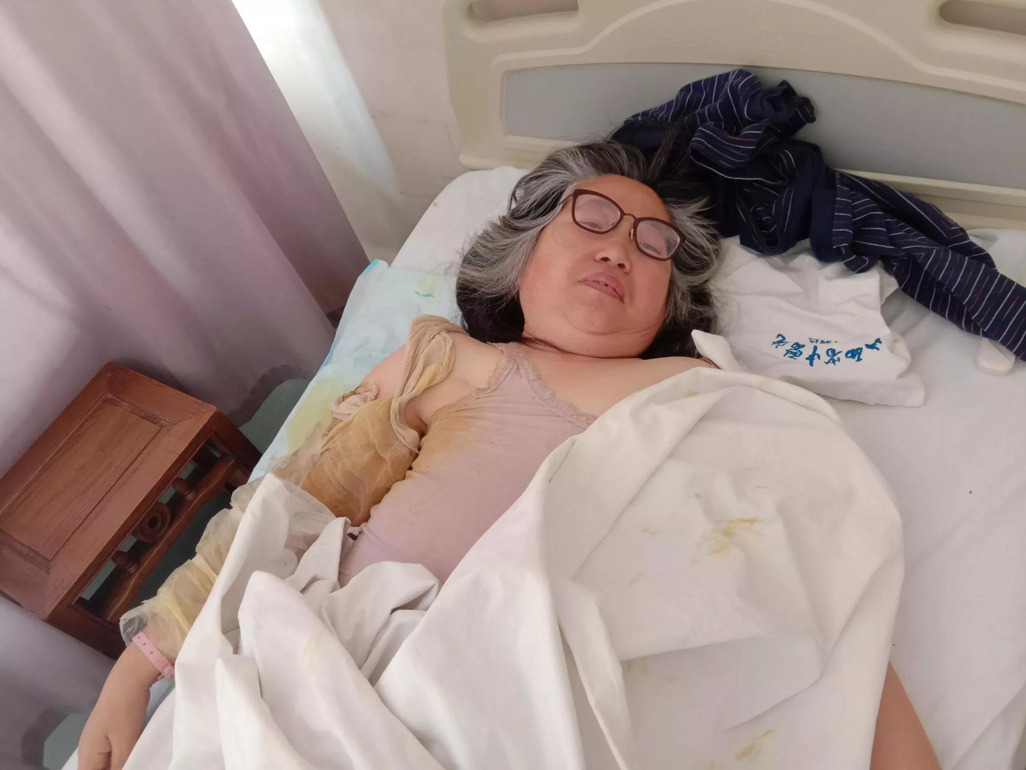 乳腺癌术后14个月复查,乳腺癌术后复查一次多少钱