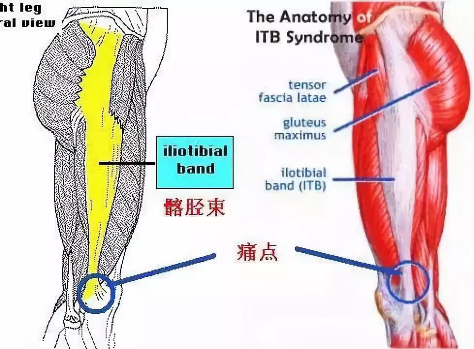 跑步后膝关节外侧有痛点,膝关节外侧疼痛还能坚持跑步吗