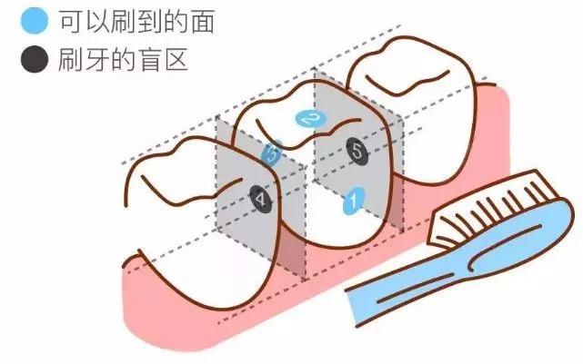 小米冲牙器伤牙,小米有品冲牙器头