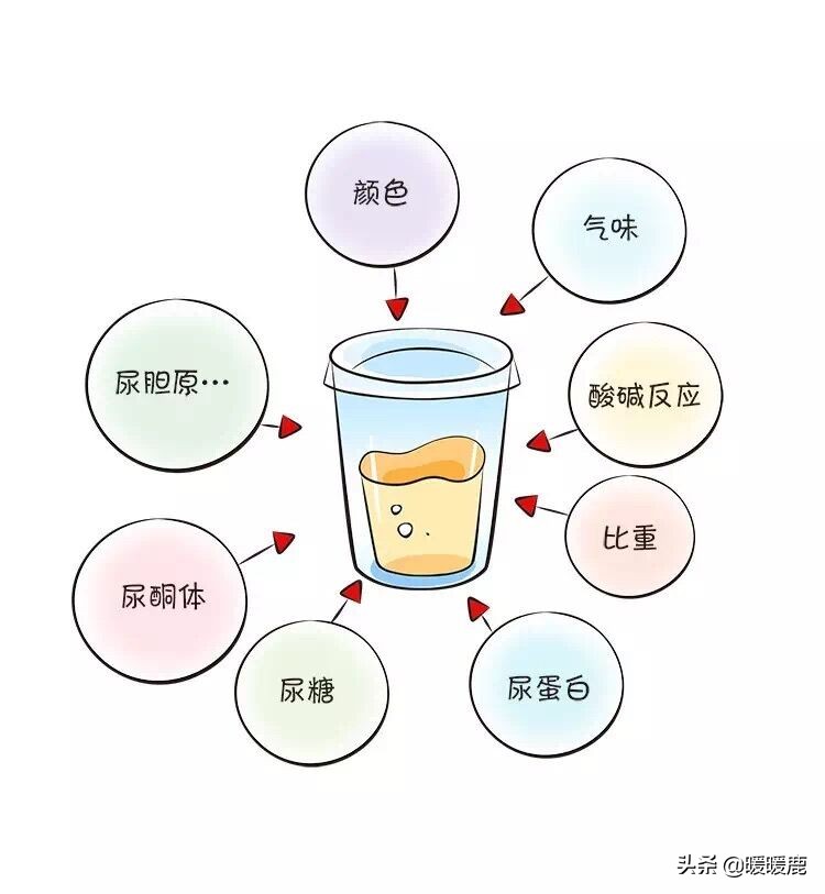 孕妇尿酮体和尿糖同时出现,怀孕尿蛋白尿糖高是怎么回事