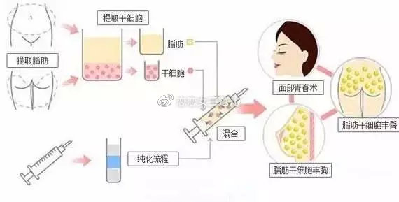 不需要运动就能瘦肚子大腿,不需要锻炼也可以增腹肌吗