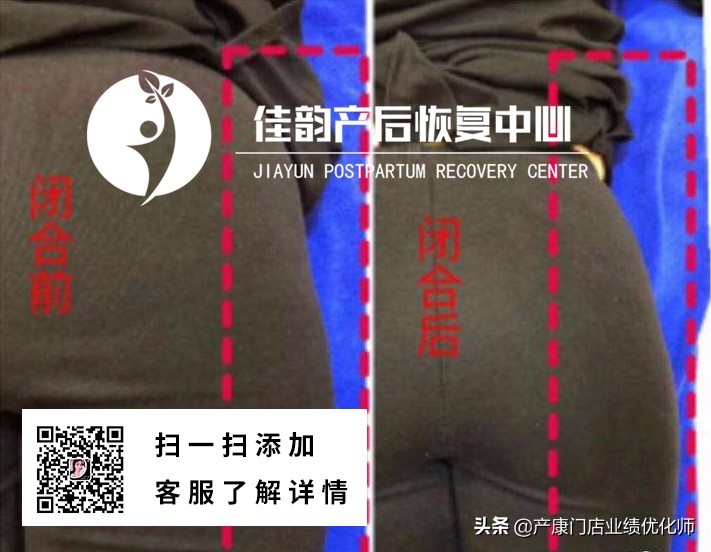 佳韵加盟可靠吗,禧韵产后恢复加盟费多少