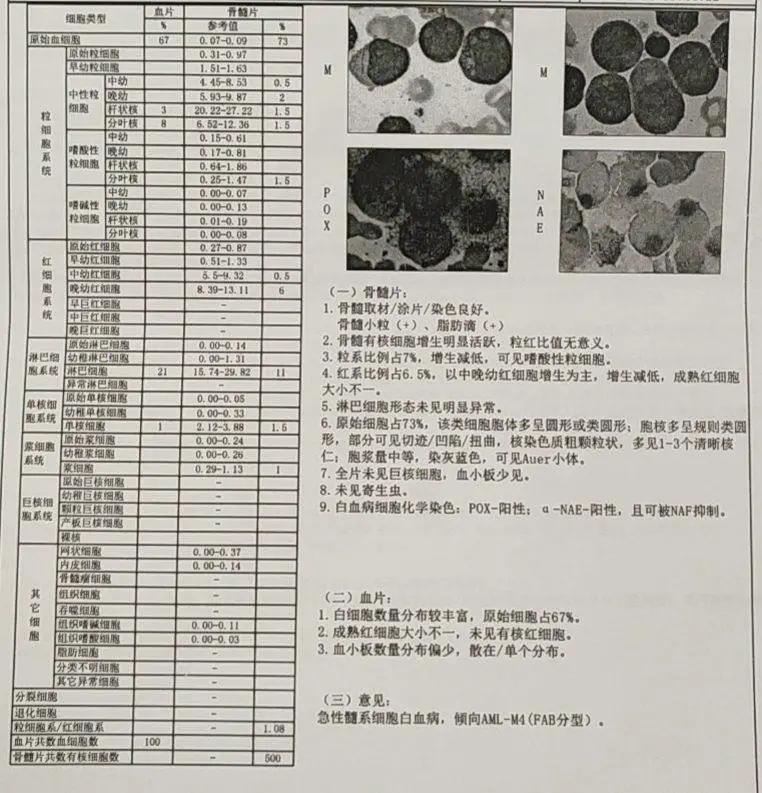 粒单不决问组化？有时还真不一定...