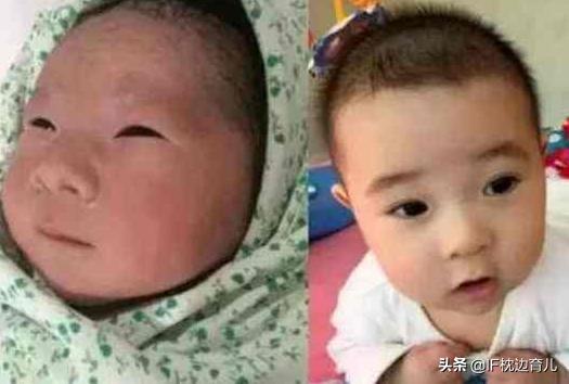 新生儿一个月后变化图,宝宝刚出生到满月的变化