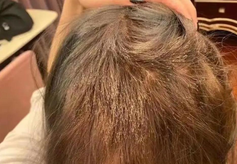 “我丑得出不了门！”女大学生花1000块染发变成这副模样：赔我20万