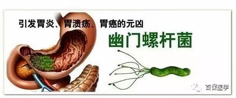 幽门螺旋杆菌需要空腹么,幽门螺旋杆菌你了解多少