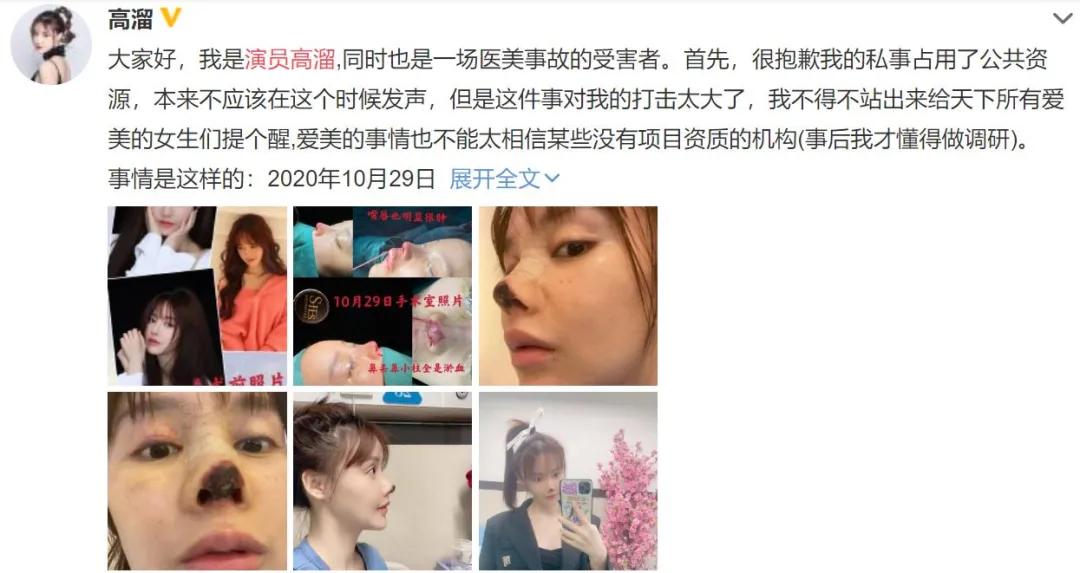 6位被整容毁掉的女星,整容把脸整得很奇怪的女星