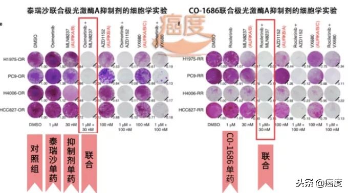 抗肿瘤靶向药品egfr,egfr靶向药品易瑞沙