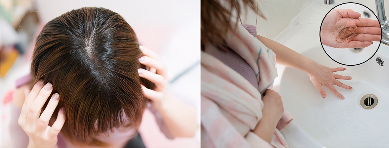 防脱固发洗发水推荐真实测评,防脱固发洗发水测评真实推荐