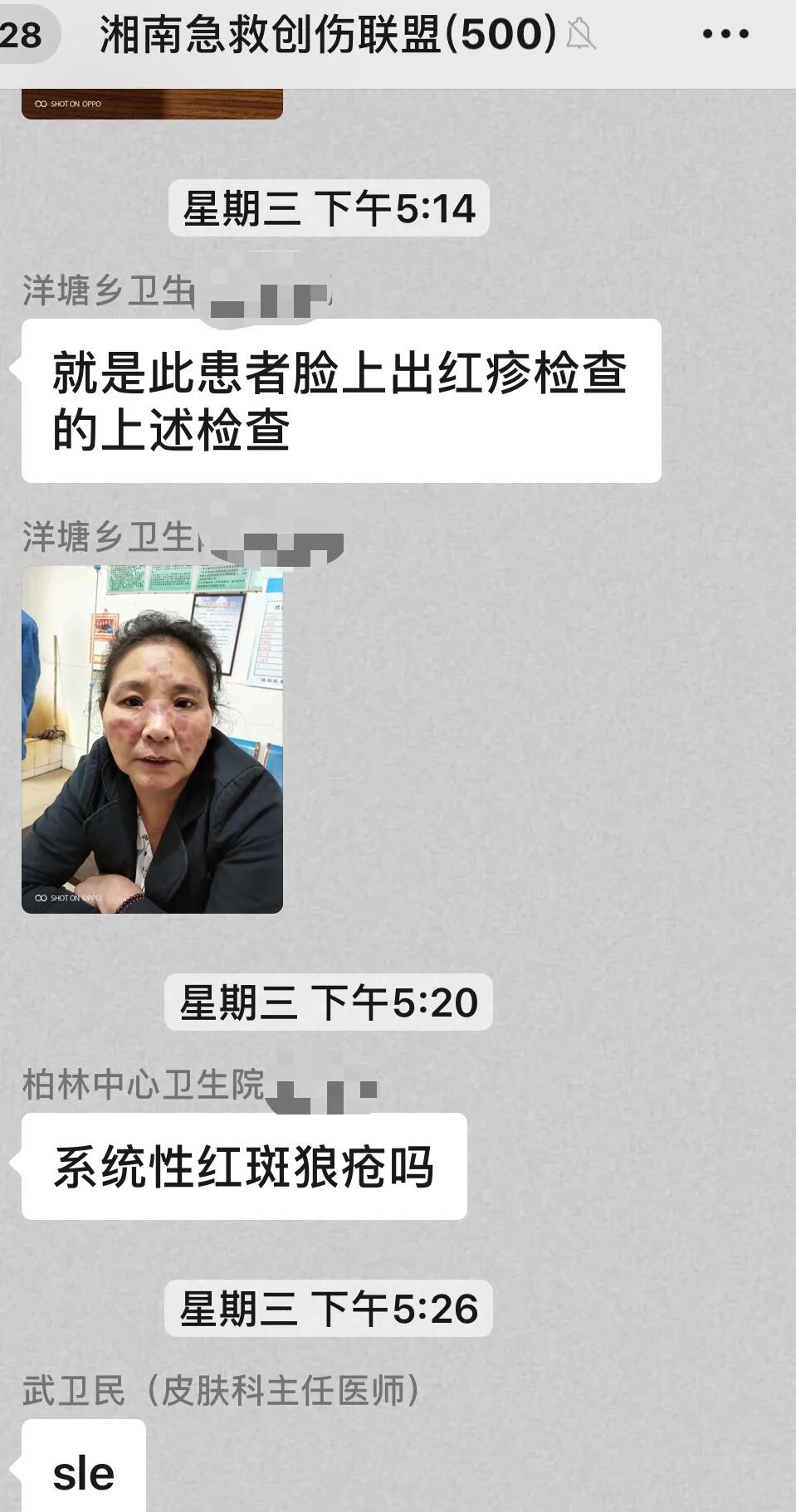 小伤口原唱完整版,小创伤解除大痛苦